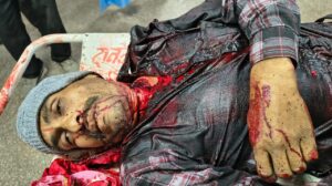 चाइनीज मांझे से कटा था गला अस्पताल ले जाते समय रास्ते में तोड़ा दम