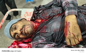 चाइनीज मांझे से गला काट अस्पताल ले जाते समय मौत 