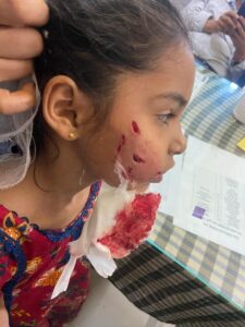 दो बच्चियों को बचाने कुत्ते से अकेले भिड़ गई मासूम