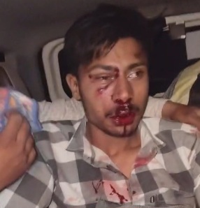 मोल्टा के पास दो बाइकों की भिड़ंत में एक व्यक्ति घायल