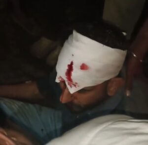 निर्माणाधीन पुलिया बनी हादसों का कारण सुरक्षा इंतजामों के अभाव में बाइक सवार गंभीर घायल